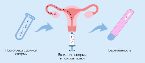 Искусственная инсеминация