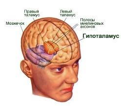 Лечение заболеваний гипоталамуса